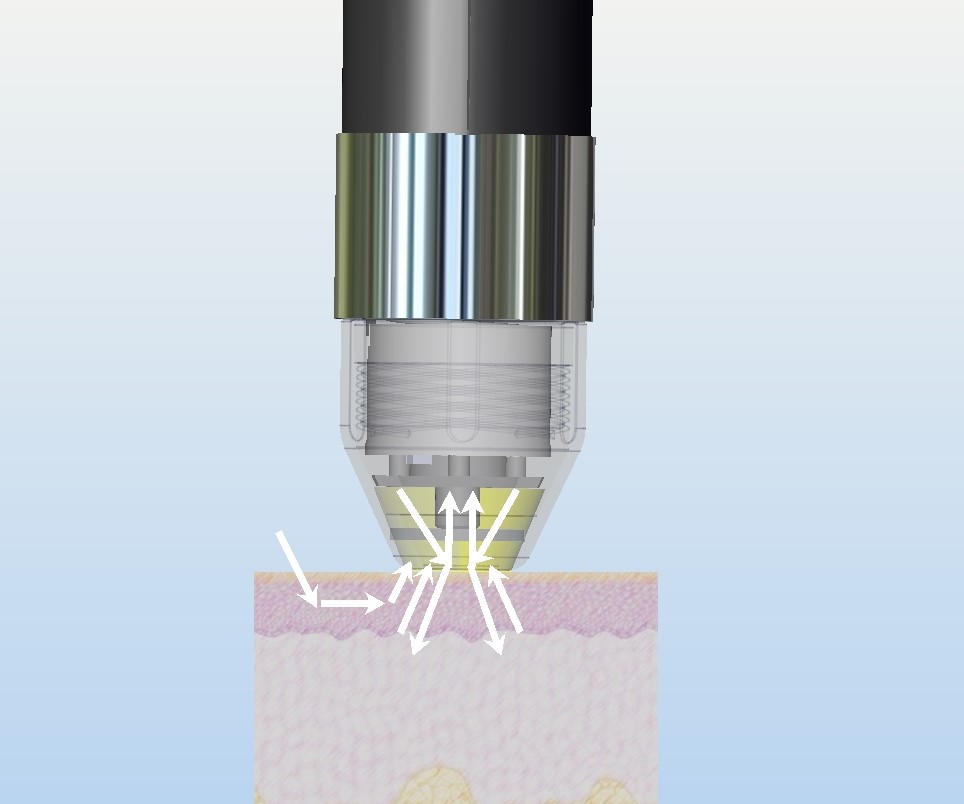 Colorimeter-flex-principle