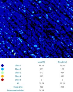 Corneofix-results-moist