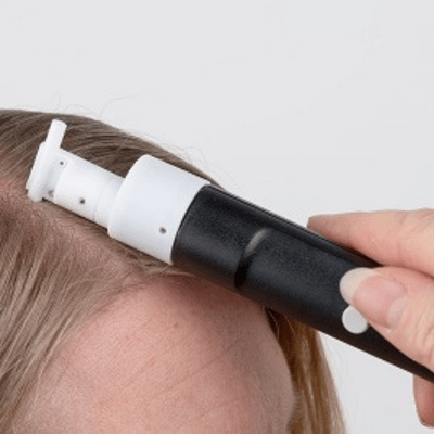 TM Nano-scalp