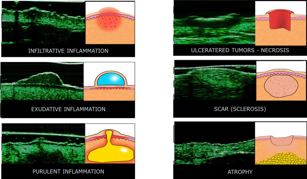 UC-dermatology