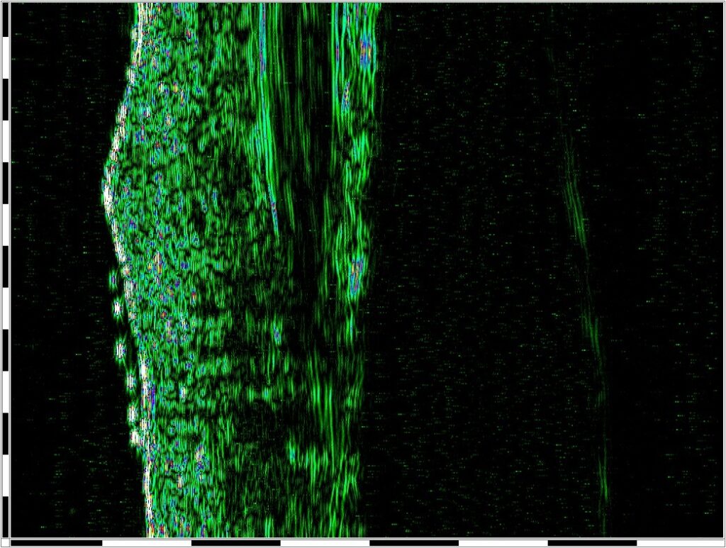 UC-scar