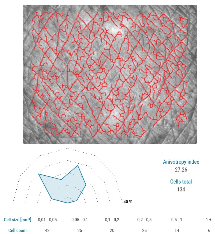 anisotropy-low
