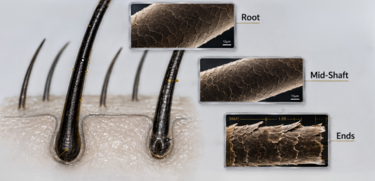 hair shaft