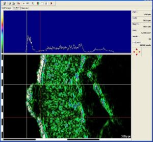 uc-ab-scan