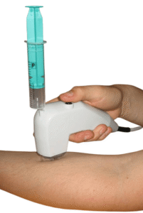 ulrascan on hand